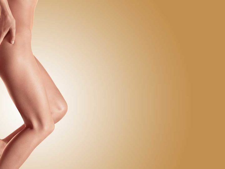 Cellulite: cause e rimedi naturali